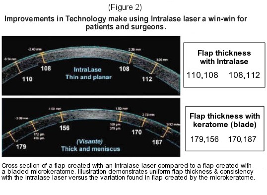 IntraLase Bladeless LASIK Eye Surgery Improvements