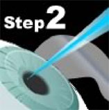 LASIK Technology Step 2 - Reshaping the Cornea
